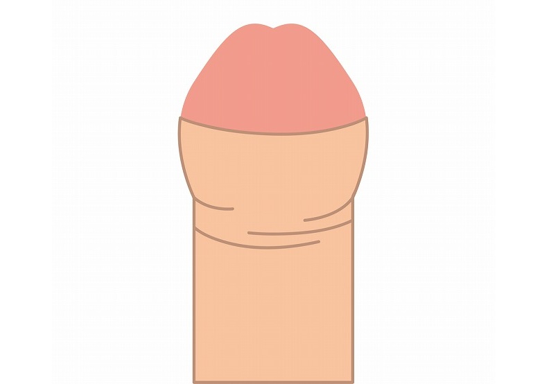 仮性包茎