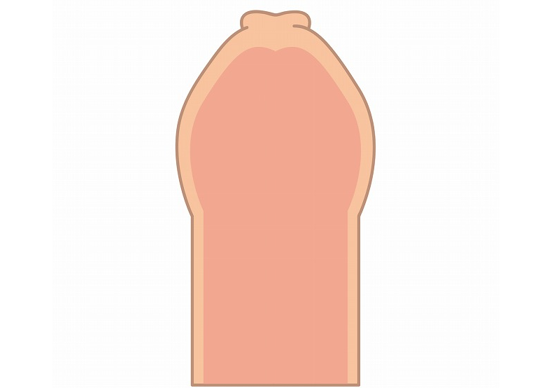 真性包茎とは